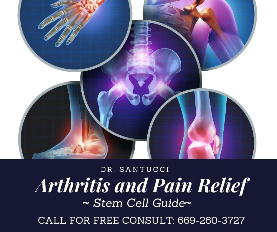 Arthritis and Joint Pain Relief Stem Cell Guide